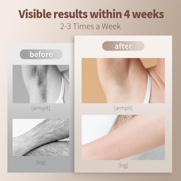 IPL Hair Removal Device New - Used Only Once! - Picture 4 of 12